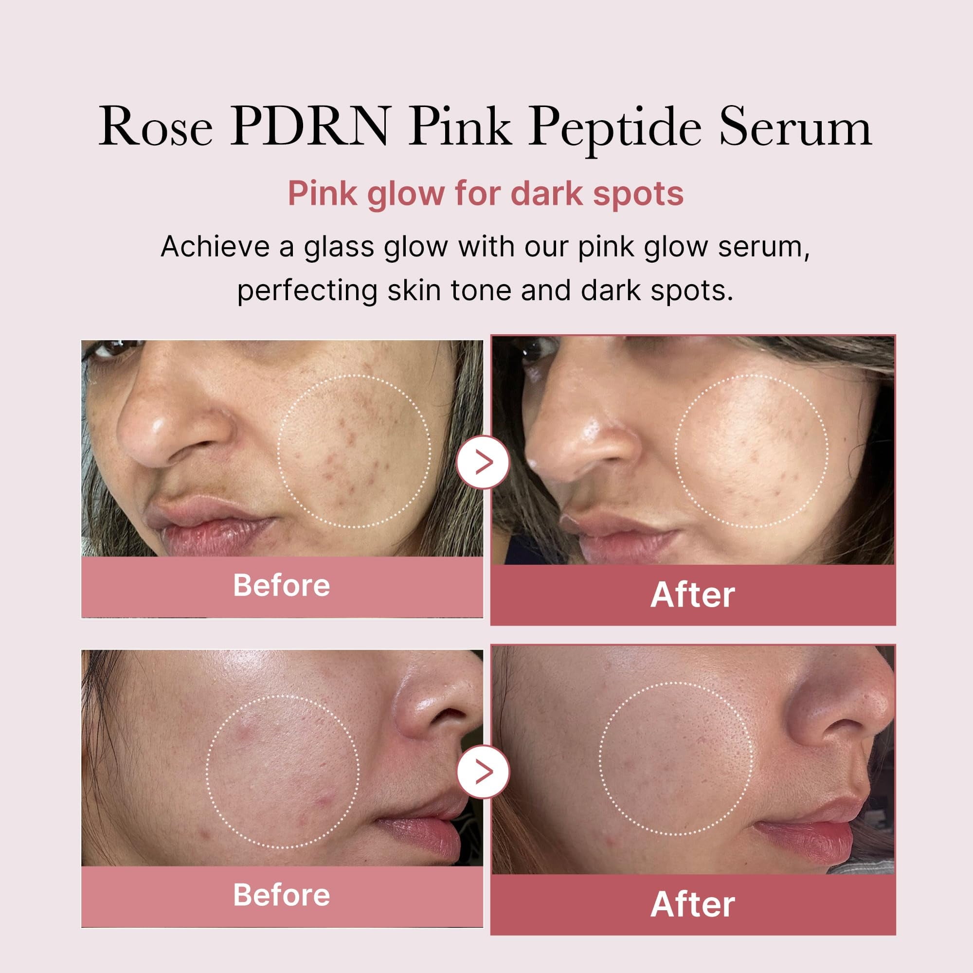 Medicube Rose PDRN Pink Peptide Serum – Hydrating, Firming, Vegan Korean Skincare for Uneven Skin Tone & Pore Care