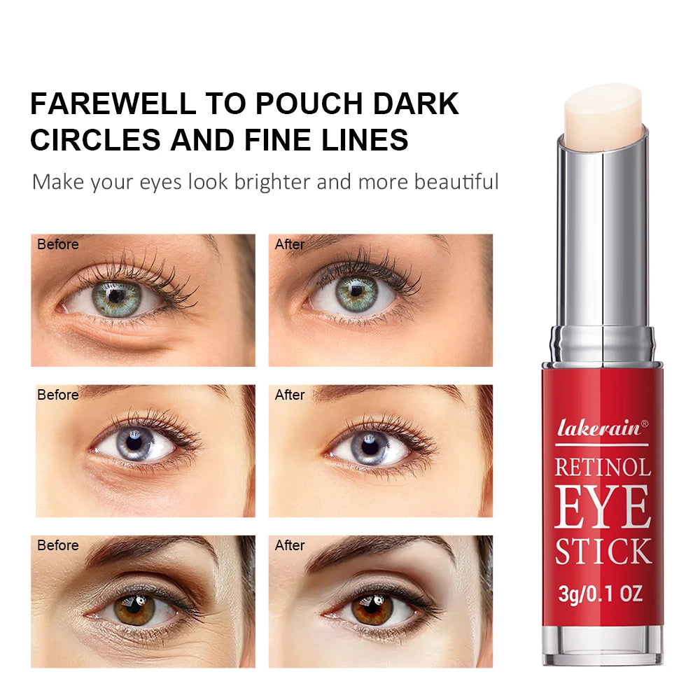 Lakerain Retinol Eye Cream Stick – Dark Circle Lightening & Firming Eye Serum for Women, 3g